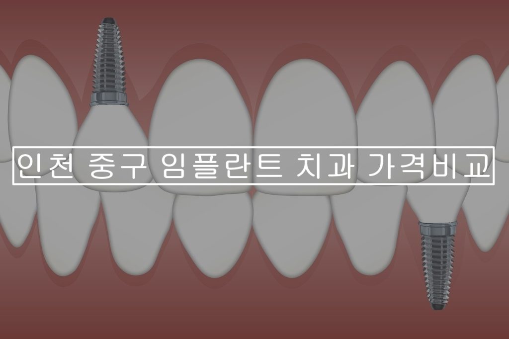 인천-중구-임플란트-치과-가격비교